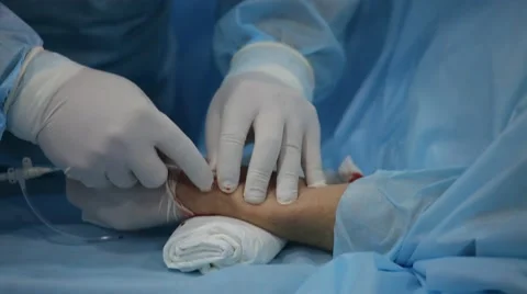 Angiographic operating: The surgeon inserts a catheter with contrast agent Stock Footage 45459854