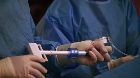 Angiography Surgery in the operating room Stock Footage 318430638