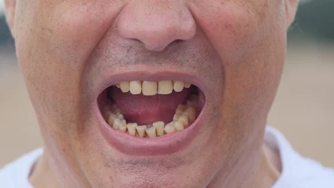 Angry man shouting at the camera, Closeup Stock Footage 93451494