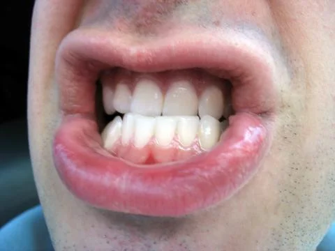Angry mouth Stock Photos