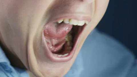 Angry young man screaming opening his mouth 库存影片 124255458