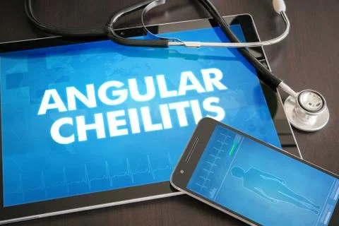 Angular cheilitis (cutaneous disease) diagnosis medical concept on tablet s.. 스톡 사진