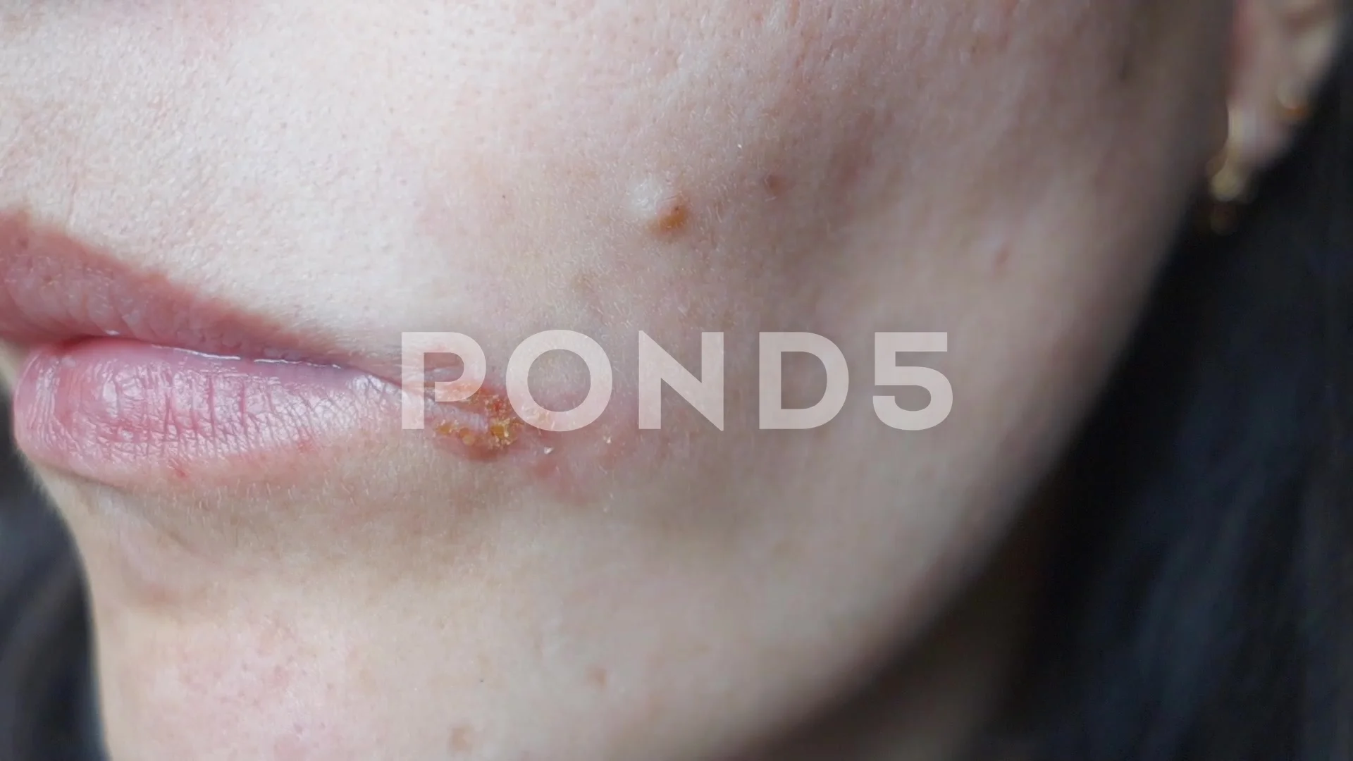 infectiosus. A girl infla... | Stock | Pond5
