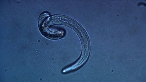 Animal parasite seen from microscope Vídeos de archivo 36422562