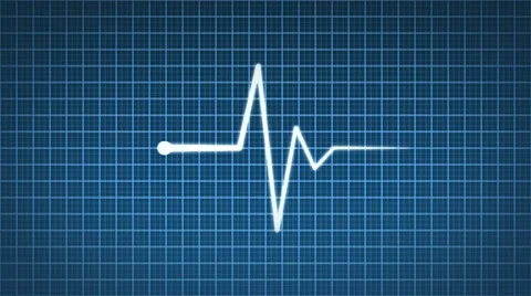 Animated cardiogram Stock Footage 10752952