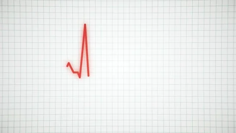 Animated cardiogram of the heart Stock Footage 158239851
