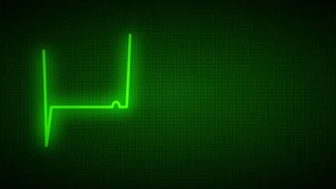 Animated cardiogram of the heart Stock Footage 158239852