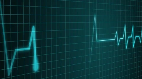 Animated ECG Heartbeat Line Loop for Medical Use, ECG Line on Dark Grid Bac.. Stock Footage 310203122