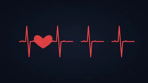 Animated ECG heartbeat pulse line medical, horizontal 16:9 seamless loop HD Stock Footage 345160648