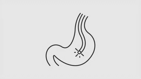 Animated gastrointestinal endoscopy line icon Stock Footage 318062501