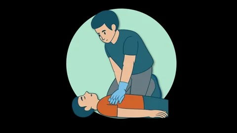 Animated Guide to Performing CPR Chest Compressions and Rescue Breaths Stock Footage 318573625