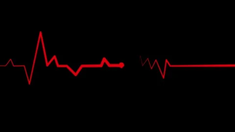 Animated Heart Rhythm Line, Simple Heartbeat Line Animation Stock Footage 309965512