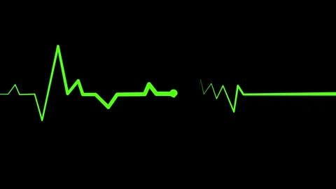 Animated Heart Rhythm Line, Simple Heartbeat Line Animation Stock Footage 309965523