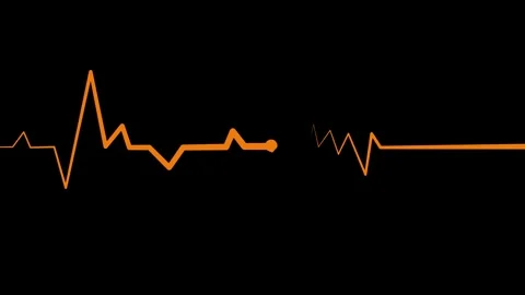 Animated Heart Rhythm Line, Simple Heartbeat Line Animation Video stock 309965527