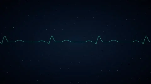 Animated Heartbeat Pulse Line Loop - Blue Medical EKG Monitor Backdrop Stock Footage 341786854