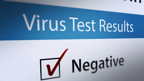 Animated Lab Virus Test with Negative and Positive Test Results Stock Footage 130787751