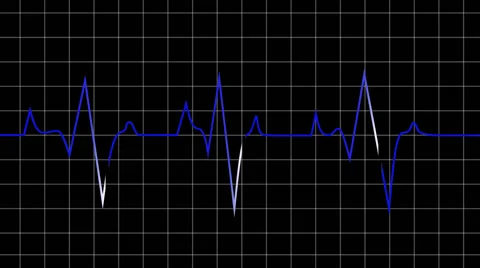 Animated loop able heart beat graphic depicted on black graph Stock Footage 60407739