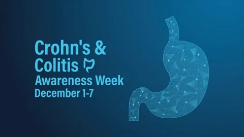 Animated Low poly style stomach Crohn’s and Colitis Awareness Week video Stock Footage 321878289