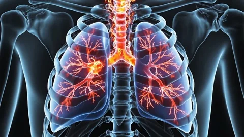 Animated medical 3d rendering showing detailed human bronchial tree pulmona.. Stock Footage 335219651