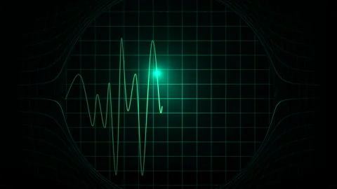 Overlay Heart Rate Green Screen Stock Videos – Royalty-Free HD & 4K ...