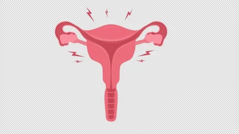 Animated uterus problems element Video stock 225868584