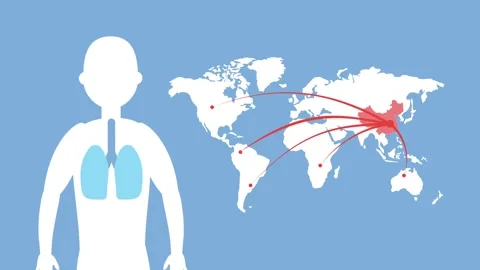 Animated vector illustration of global virus spread starting from China sho.. Stock-Footage 339045387