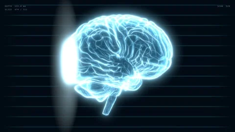 Animated x-ray human brain with scanning light line sweeping across 스톡 동영상 346873207