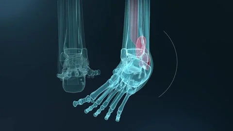 Animating 3D legs at medical studio with right foot pointing, pressing heel pad, Vídeos de archivo 346154906