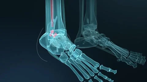 Animating 3D skeletal legs pivoting left foot inward at ankle in studio, showing Vídeos de archivo 346154902
