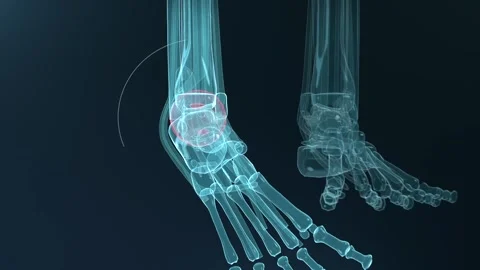 Animating x-ray ankle rotating fanning and reforming on playback in lab showing Vídeos de archivo 346154914