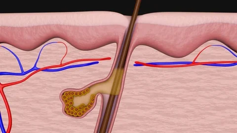 Animation of acne Video stock 152745377