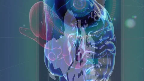 Animation of brain rotating over world map and screens with diverse data Stock Footage 312618325