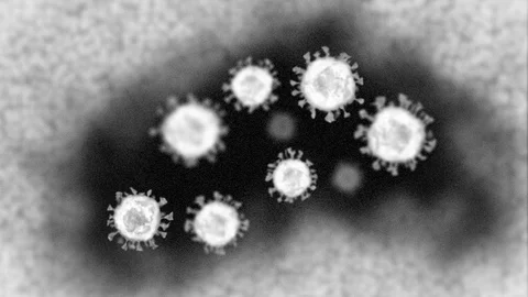 Animation of coronavirus particles under electron microscope Stock Footage 128371837