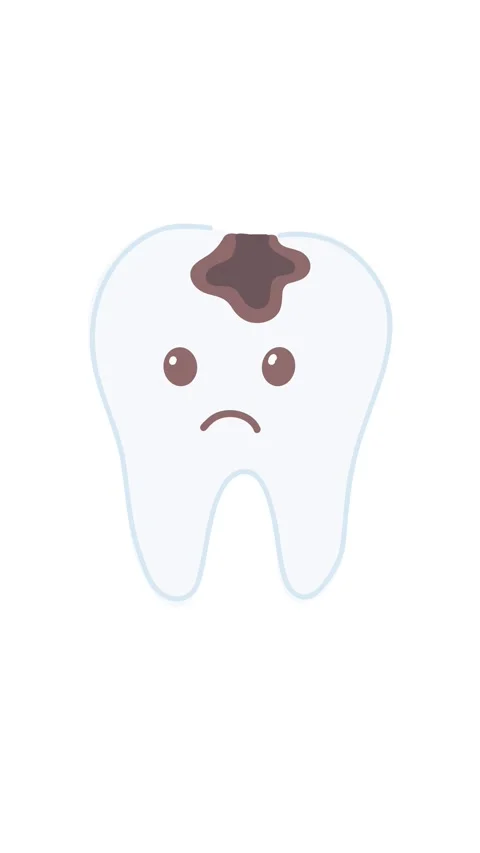Animation dental caries development on tooth surface Stock Footage 336650539