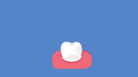 Animation dental crown placement procedure on white background Stock Footage 336650549