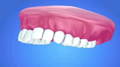 Animation of Dental Implants Replacing Missing Teeth Stock Footage 327669788
