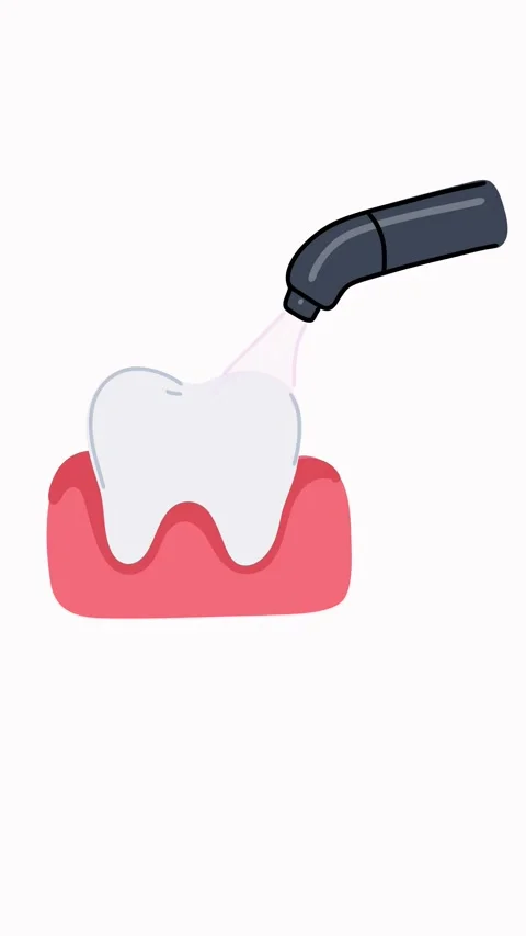 Animation dental led curing lamp activating composite restoration Stock Footage 336650564
