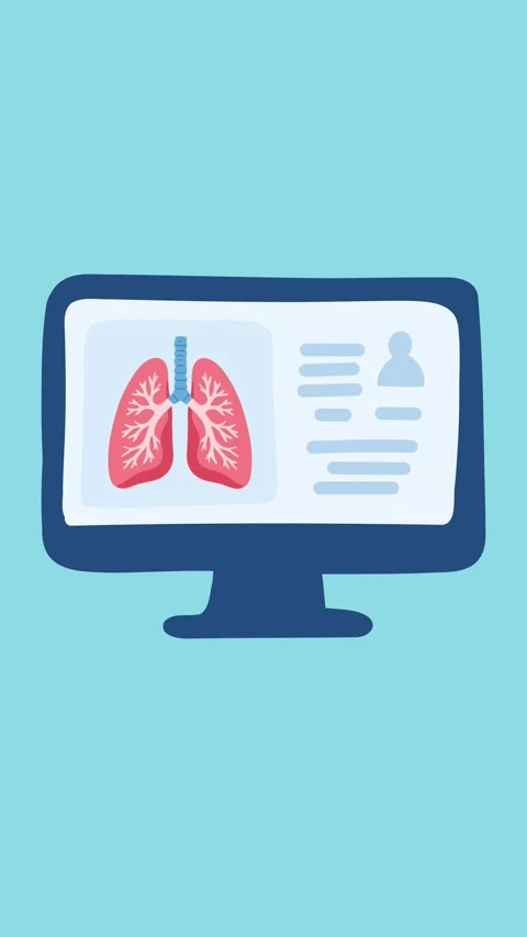 Animation of digital lung analysis on medical monitor Stock Footage 340956465