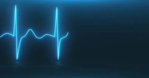Animation of drawing a blue luminous cardiogram on a blue background Stock Footage 240834322