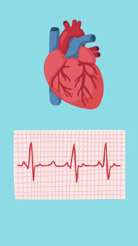 Animation of electrocardiogram for heart diagnosis Stock Footage 340956430