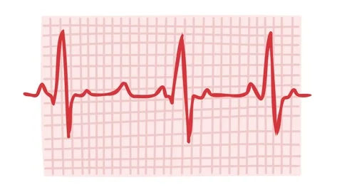 Animation of electrocardiogram heartbeat waveform Stock Footage 340879121