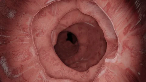 Animation of a Enteroscopy of the human intestines Vídeos de archivo 137111910