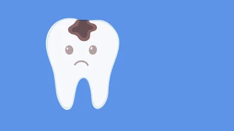 Animation featuring tooth with visible decay development Stock Footage 336298589