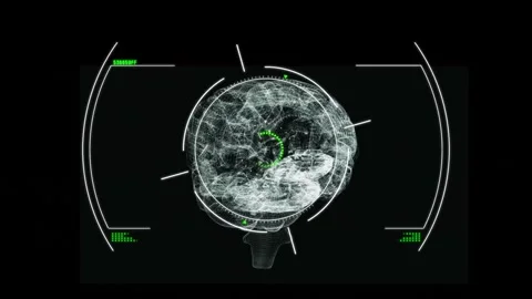 Animation of glitch effect and scope scanning over spinning human brain icon on Stock Footage 230188887