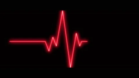 Ekg Animation Heartbeat Stock Video Footage | Royalty Free Ekg Animation  Heartbeat Videos | Pond5