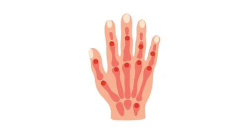 Animation of human hand skeleton anatomy Stock Footage 340879076