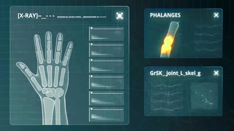Animation of a human hand x-ray displaye... | Stock Video | Pond5