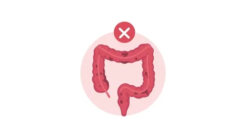 Animation of inflamed colon disease concept Stock Footage 340879088