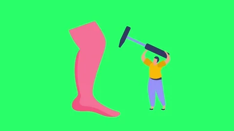 Animation knee examination isolate on green screen. Stock Footage 276428452