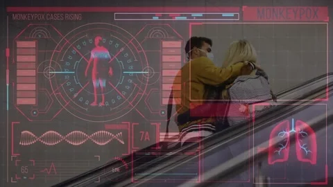 Animation of monkey pox over digital screen with data and caucasian couple Vídeo Stock 202347127